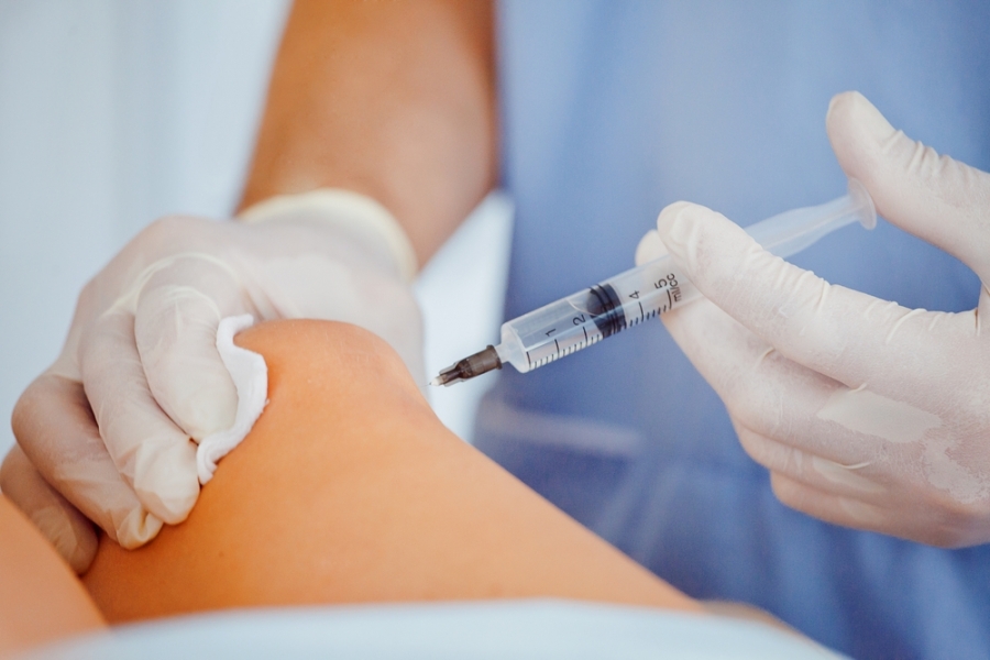 Escleroterapia Ecoguiada com Espuma tem resultados positivos.