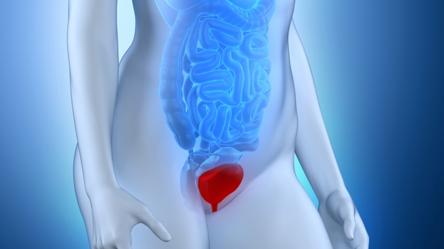 PROLAPSO GENITAL