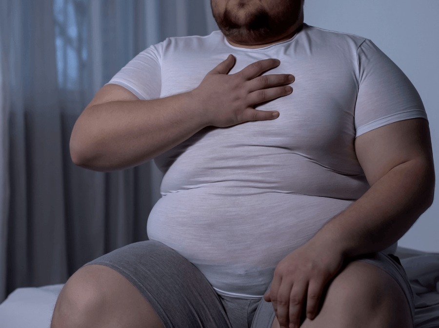 OBESIDADE X CIRURGIA BARIÁTRICA