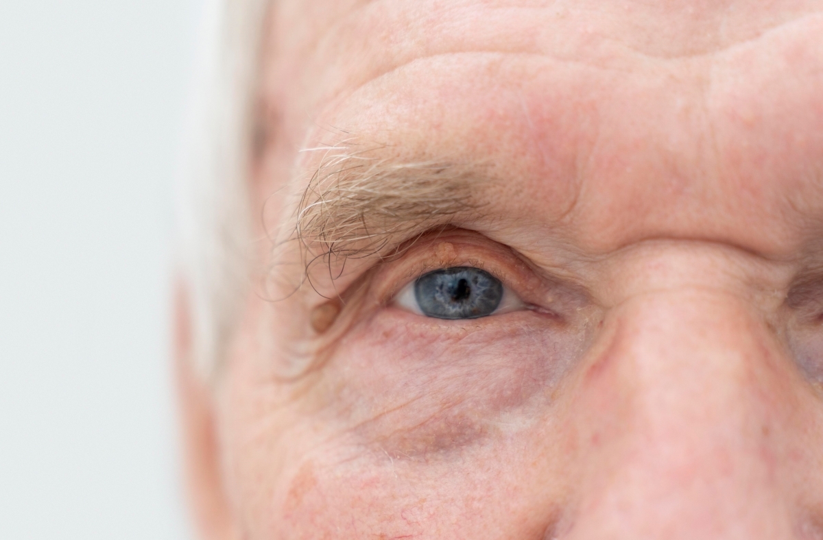 ABRA OS OLHOS PARA O GLAUCOMA