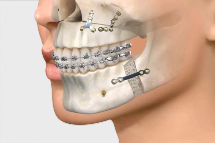 Capa do artigo Dr. André Pedroso, referência regional em Cirurgia e Traumatologia Bucomaxilofacial