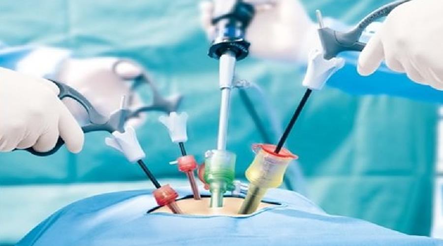 O QUE VOCÊ PRECISA SABER SOBRE VIDEOCIRURGIA NA GINECOLOGIA