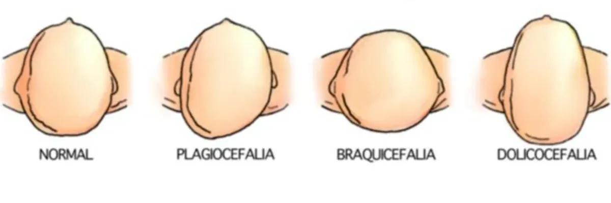 Osteopatia Pediátrica: Uma abordagem integral e segura, que auxilia o desenvolvimento dos bebês