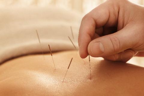 FISIATRIA E ACUPUNTURA: CONTRA DOR, PARA REABILITAR