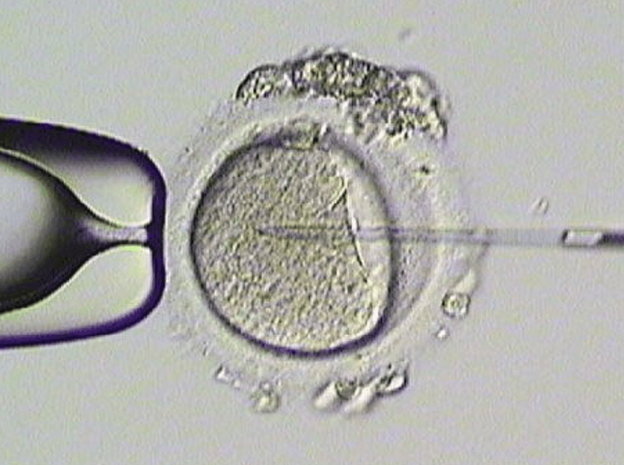 Fertilização in vitro